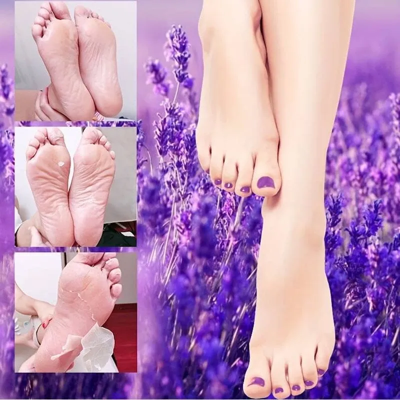 Exfoliating Peeling Socks