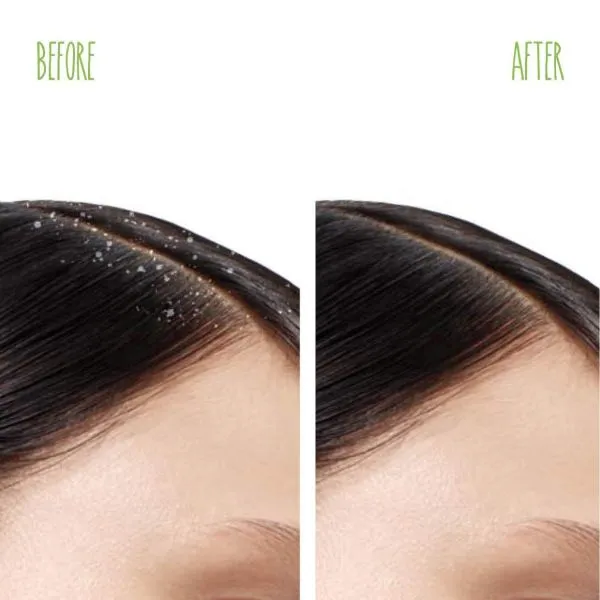 Matrix Biolage Advance Scalppure Dandruff Shampoo (200ml)