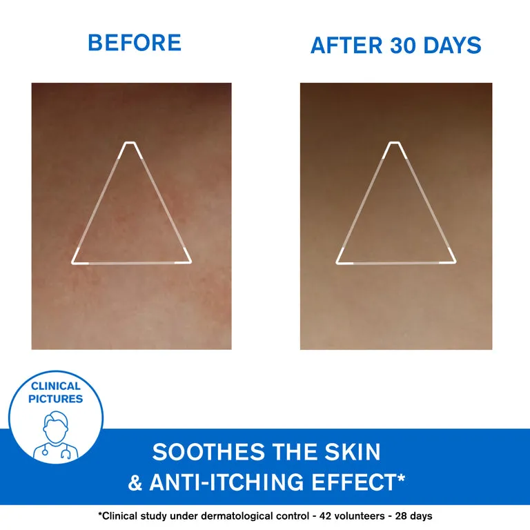 X??|mose Lipid-Replenishing Anti-Irritation Cerat - Extreme Skin Dryness - Skin Prone to Atopy
