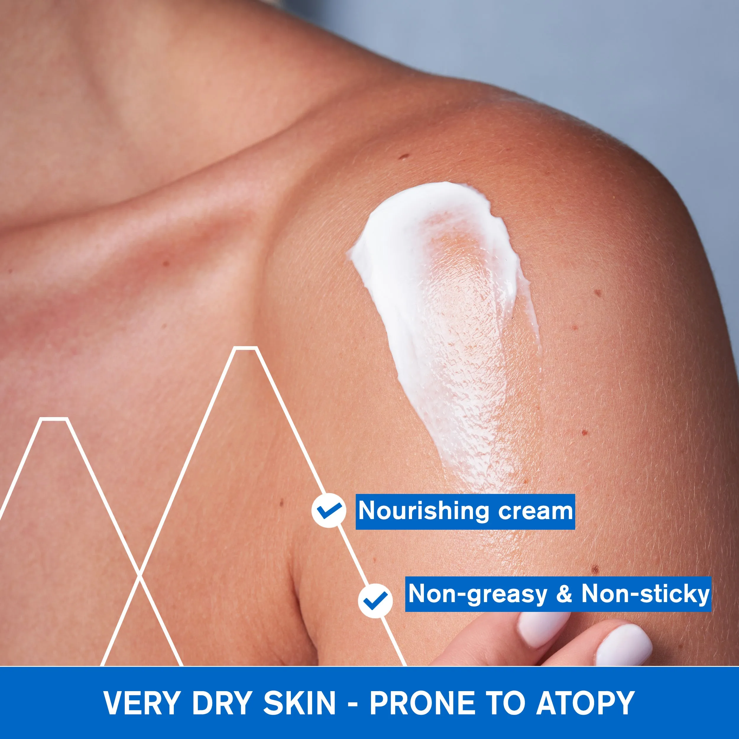 X??|mose Lipid-Replenishing Anti-Irritation Cream - Very Dry Skin Prone to Atopy
